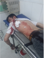 Hình ảnh anh D bị thương nặng.