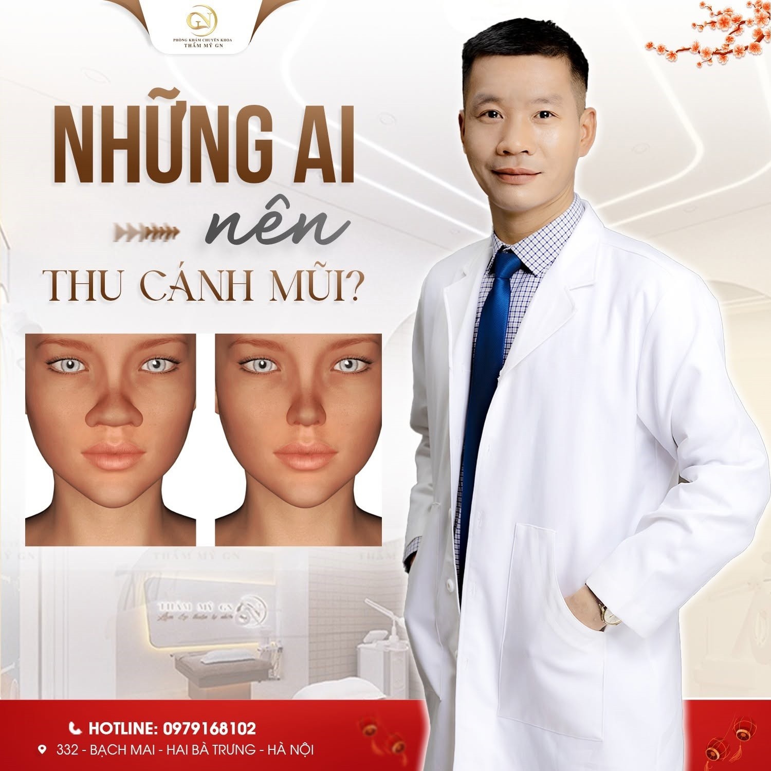 nhung-ai-nen-thu-canh-mui-1789393898.jpg