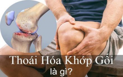 Tại sao người bị thoái hóa khớp gối nên sử dụng Hoàng Thấp Linh?