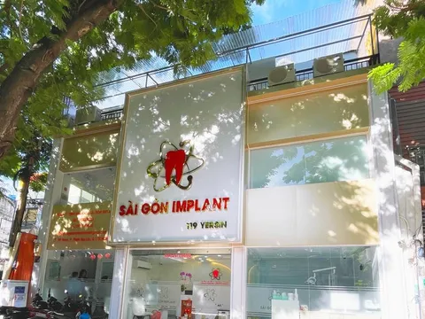 Why Dr. Nguyen Ngoc Tan is Redefining Full-Arch Implant Excellence in Vietnam